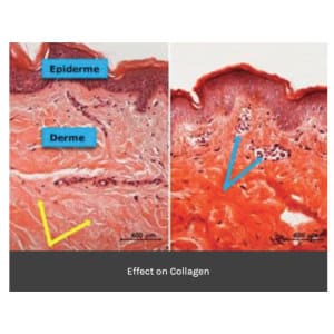 effect on collagen